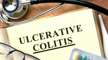 4 signs that indicate ulcerative colitis development